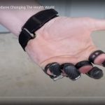 13 Medical Procedures Changing The Health World